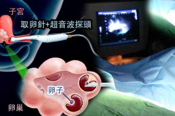 武汉正规助孕费用 武汉最出名的试管医院有哪些 ‘彩超那里看男女’